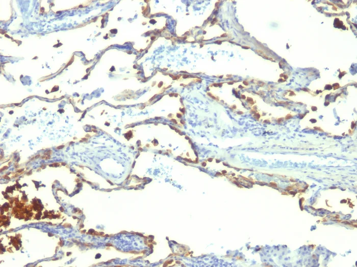 Immunohistochemistry (Formalin/PFA-fixed paraffin-embedded sections) - Anti-Milk Fat Globule 1 antibody [SPM291] (AB17787)