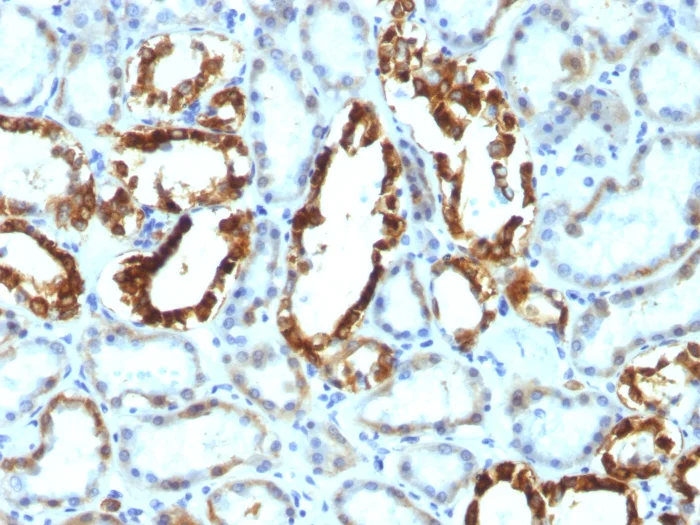 Immunohistochemistry (Formalin/PFA-fixed paraffin-embedded sections) - Anti-Milk Fat Globule 1 antibody [SPM291] (AB17787)