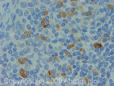 Immunohistochemistry (Formalin/PFA-fixed paraffin-embedded sections) - Anti-Mineralocorticoid Receptor antibody (AB64457)