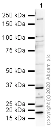 Western blot - Anti-Mineralocorticoid Receptor antibody (AB64457)