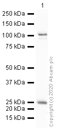 Western blot - Anti-Mineralocorticoid Receptor antibody (AB64457)