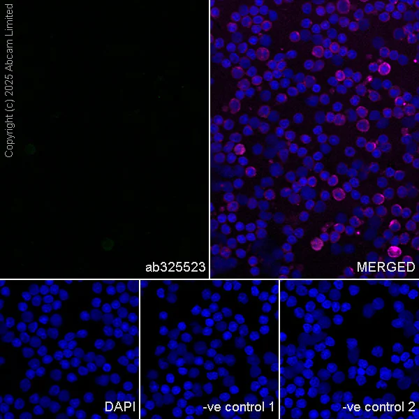 Immunocytochemistry/ Immunofluorescence - Anti-Mineralocorticoid Receptor antibody [EPR29519-576] (AB325523)
