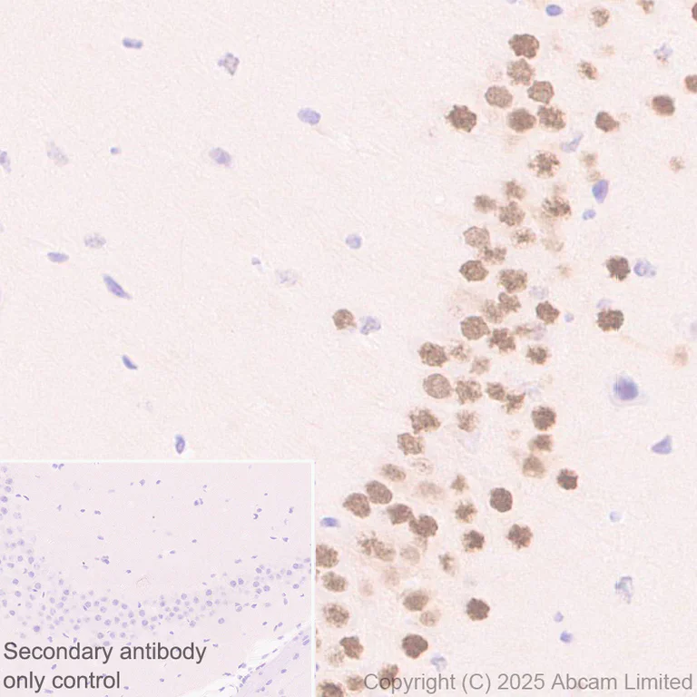 Immunohistochemistry (Formalin/PFA-fixed paraffin-embedded sections) - Anti-Mineralocorticoid Receptor antibody [EPR29519-576] (AB325523)