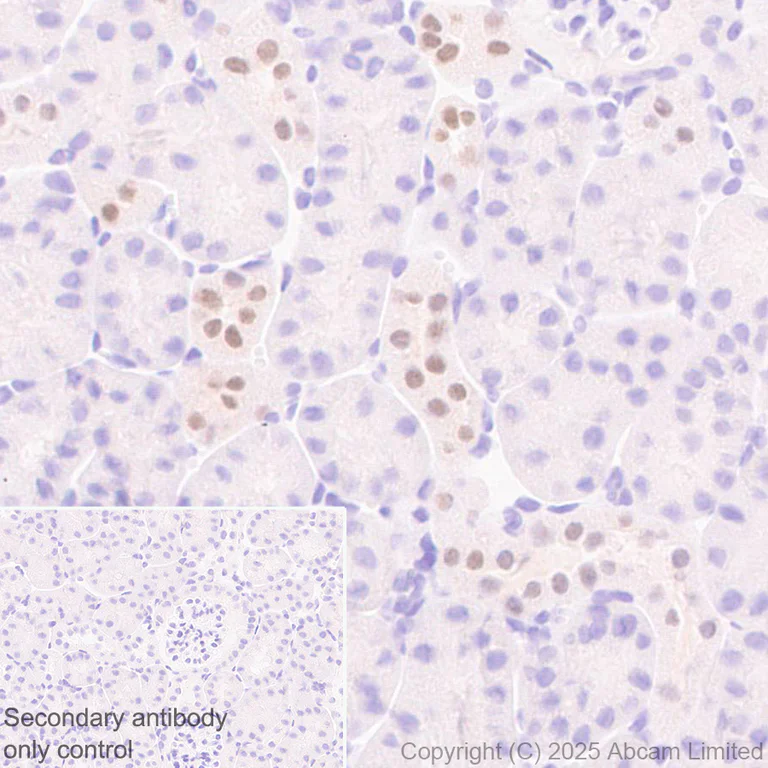 Immunohistochemistry (Formalin/PFA-fixed paraffin-embedded sections) - Anti-Mineralocorticoid Receptor antibody [EPR29519-576] (AB325523)