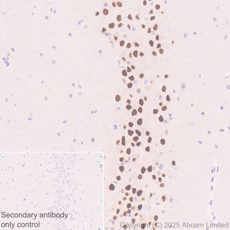 Immunohistochemistry (Formalin/PFA-fixed paraffin-embedded sections) - Anti-Mineralocorticoid Receptor antibody [EPR29519-576] (AB325523)