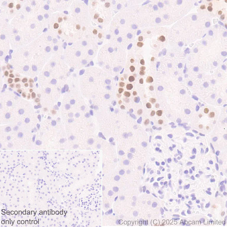 Immunohistochemistry (Formalin/PFA-fixed paraffin-embedded sections) - Anti-Mineralocorticoid Receptor antibody [EPR29519-576] (AB325523)