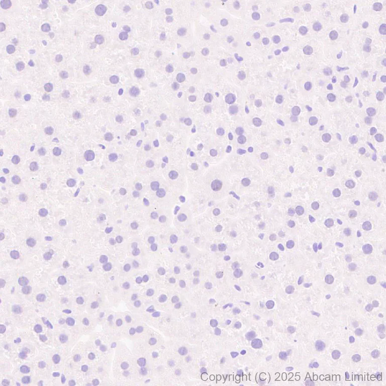 Immunohistochemistry (Formalin/PFA-fixed paraffin-embedded sections) - Anti-Mineralocorticoid Receptor antibody [EPR29519-576] (AB325523)