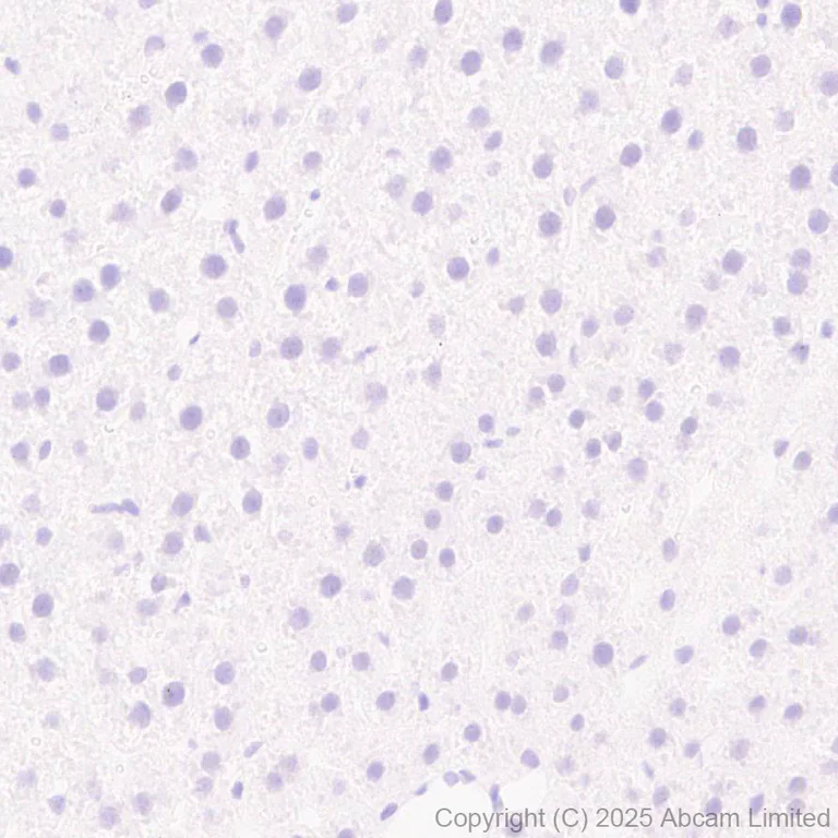 Immunohistochemistry (Formalin/PFA-fixed paraffin-embedded sections) - Anti-Mineralocorticoid Receptor antibody [EPR29519-576] (AB325523)