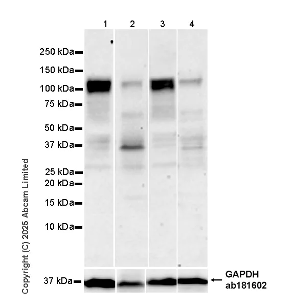 Western blot - Anti-Mineralocorticoid Receptor antibody [EPR29519-576] (AB325523)