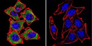 Immunocytochemistry/ Immunofluorescence - Anti-Mineralocorticoid Receptor antibody [H10E4C9F] (AB2774)