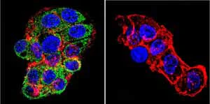 Immunocytochemistry/ Immunofluorescence - Anti-Mineralocorticoid Receptor antibody [H10E4C9F] (AB2774)