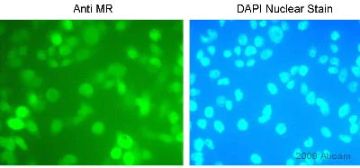 Immunocytochemistry/ Immunofluorescence - Anti-Mineralocorticoid Receptor antibody [H10E4C9F] (AB2774)