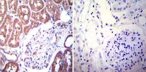 Immunohistochemistry (Formalin/PFA-fixed paraffin-embedded sections) - Anti-Mineralocorticoid Receptor antibody [H10E4C9F] (AB2774)