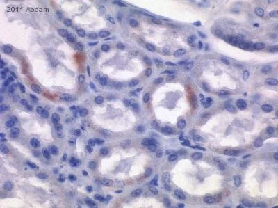 Immunohistochemistry (Formalin/PFA-fixed paraffin-embedded sections) - Anti-Mineralocorticoid Receptor antibody [H10E4C9F] (AB2774)