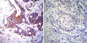 Immunohistochemistry (Formalin/PFA-fixed paraffin-embedded sections) - Anti-Mineralocorticoid Receptor antibody [H10E4C9F] (AB2774)
