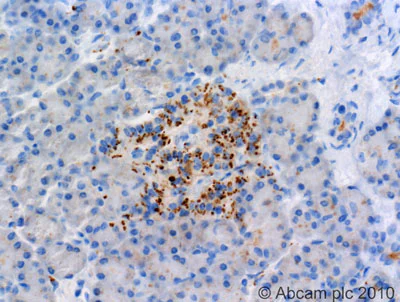Immunohistochemistry (Formalin/PFA-fixed paraffin-embedded sections) - Anti-Mineralocorticoid Receptor antibody [H10E4C9F] (AB2774)