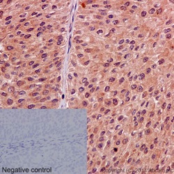 Immunohistochemistry (Formalin/PFA-fixed paraffin-embedded sections) - Anti-Mint-1 antibody [EPR15941] - BSA and Azide free (AB251021), expandable thumbnail