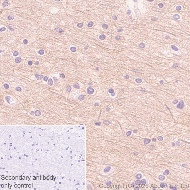Immunohistochemistry (Formalin/PFA-fixed paraffin-embedded sections) - Anti-Mint-1 antibody [EPR15941] - N-terminal (AB190359)