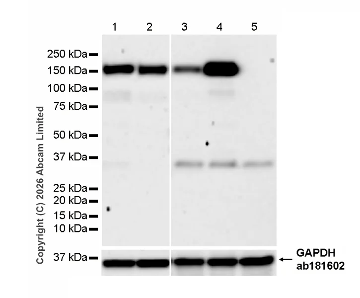 Western blot - Anti-Mint-1 antibody [EPR15941] - N-terminal (AB190359)