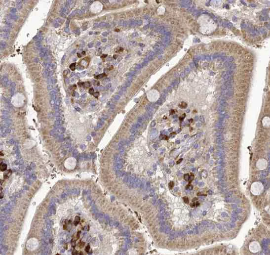 Immunohistochemistry (Formalin/PFA-fixed paraffin-embedded sections) - Anti-MIOS antibody (AB122822)