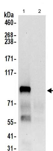 Immunoprecipitation - Anti-MIOS antibody (AB202274), expandable thumbnail