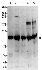 Western blot - Anti-MIOS antibody (AB202274), expandable thumbnail