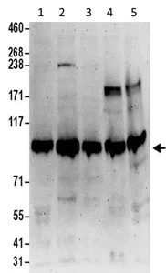 Western blot - Anti-MIOS antibody (AB202274)
