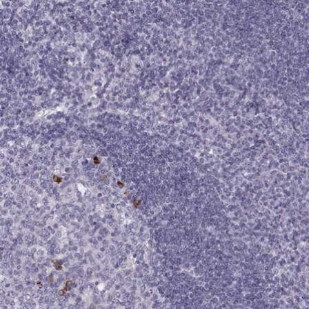 Immunohistochemistry (Formalin/PFA-fixed paraffin-embedded sections) - Anti-MIP-3 beta/CCL19 antibody (AB221704)