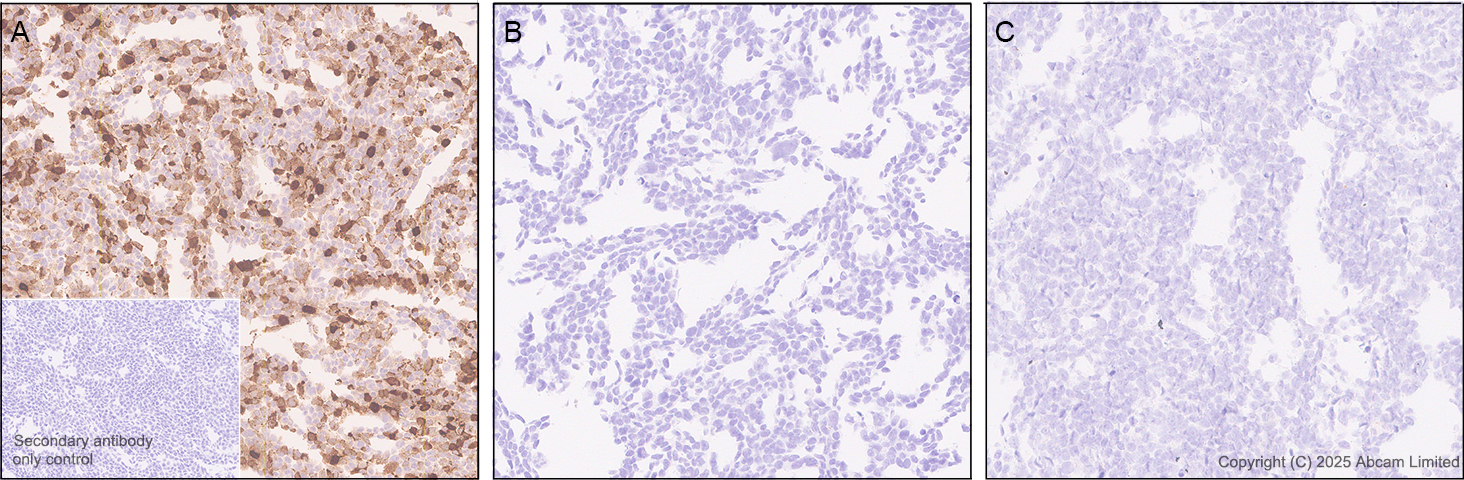 Immunohistochemistry (Formalin/PFA-fixed paraffin-embedded sections) - Anti-MIP-3 beta/CCL19 antibody [EPR27463-29] (AB324163), expandable thumbnail