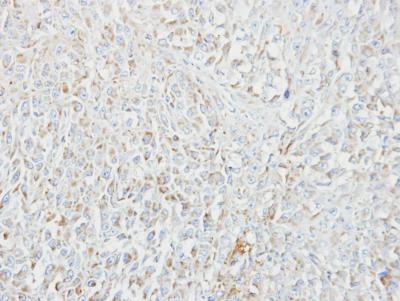 Immunohistochemistry (Formalin/PFA-fixed paraffin-embedded sections) - Anti-MIPEP antibody (AB154407), expandable thumbnail