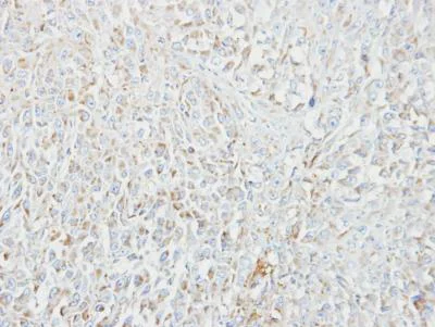 Immunohistochemistry (Formalin/PFA-fixed paraffin-embedded sections) - Anti-MIPEP antibody (AB154407)