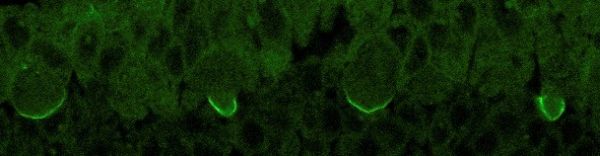 Immunohistochemistry (Formalin/PFA-fixed paraffin-embedded sections) - Anti-Miranda antibody [CD#5- 7E9BG5AF4] (AB197788), expandable thumbnail