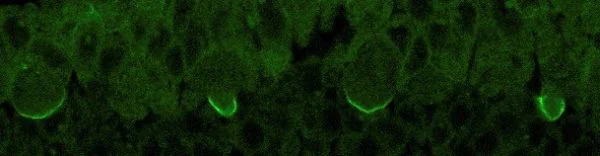 Immunohistochemistry (Formalin/PFA-fixed paraffin-embedded sections) - Anti-Miranda antibody [CD#5- 7E9BG5AF4] (AB197788)