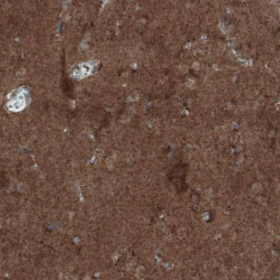 Immunohistochemistry (Formalin/PFA-fixed paraffin-embedded sections) - Anti-MIRO1 antibody [CL1083] (AB188029)