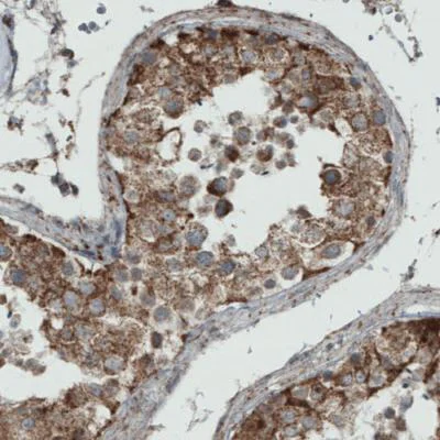 Immunohistochemistry (Formalin/PFA-fixed paraffin-embedded sections) - Anti-MIRO1 antibody [CL1083] (AB188029)