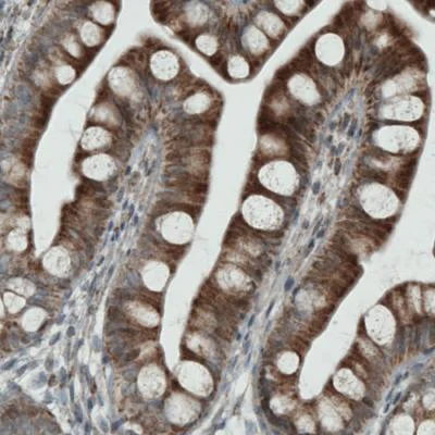 Immunohistochemistry (Formalin/PFA-fixed paraffin-embedded sections) - Anti-MIRO1 antibody [CL1083] (AB188029)