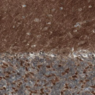 Immunohistochemistry (Formalin/PFA-fixed paraffin-embedded sections) - Anti-MIRO1 antibody [CL1083] (AB188029)