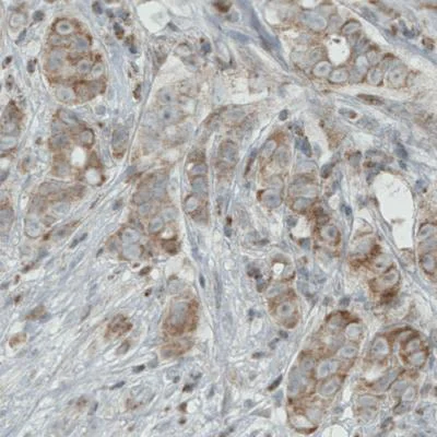 Immunohistochemistry (Formalin/PFA-fixed paraffin-embedded sections) - Anti-MIRO1 antibody [CL1083] (AB188029)