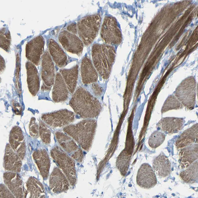 Immunohistochemistry (Formalin/PFA-fixed paraffin-embedded sections) - Anti-MIRO2 antibody (AB224089)