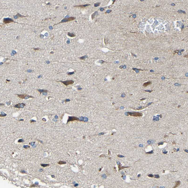 Anti-MIRO2 antibody (ab224089) | Abcam