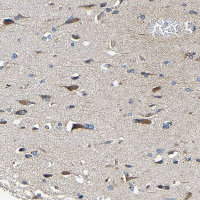 Anti-MIRO2 antibody (ab224089) | Abcam