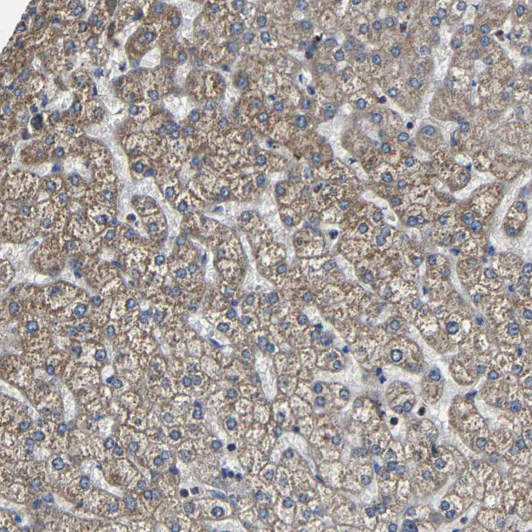 Immunohistochemistry (Formalin/PFA-fixed paraffin-embedded sections) - Anti-MIRO2 antibody (AB224089)
