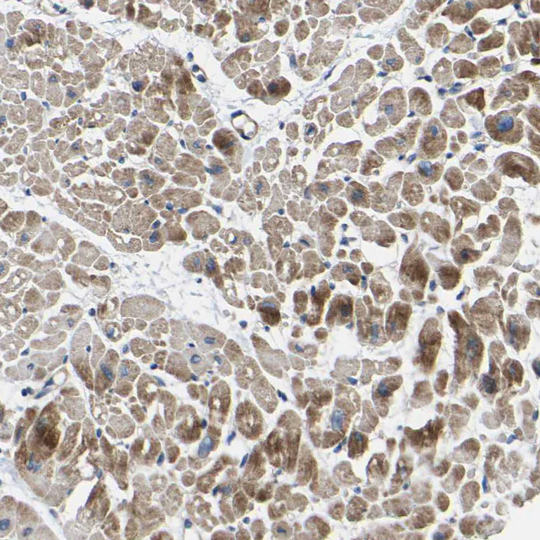 Immunohistochemistry (Formalin/PFA-fixed paraffin-embedded sections) - Anti-MIRO2 antibody (AB224089)