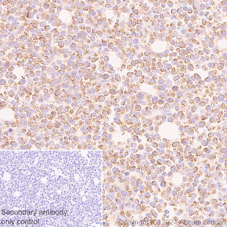 Immunohistochemistry (Formalin/PFA-fixed paraffin-embedded sections) - Anti-MIRO2 antibody [EPR29118-10] (AB321803)