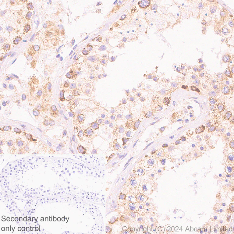 Immunohistochemistry (Formalin/PFA-fixed paraffin-embedded sections) - Anti-MIRO2 antibody [EPR29118-10] - BSA and Azide free (AB321804)