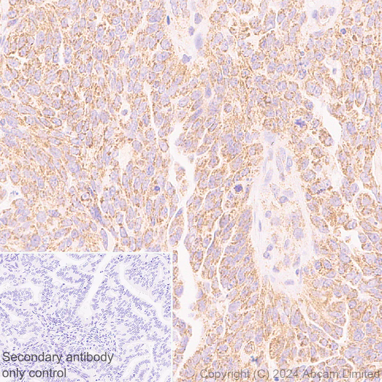 Immunohistochemistry (Formalin/PFA-fixed paraffin-embedded sections) - Anti-MIRO2 antibody [EPR29118-10] - BSA and Azide free (AB321804)
