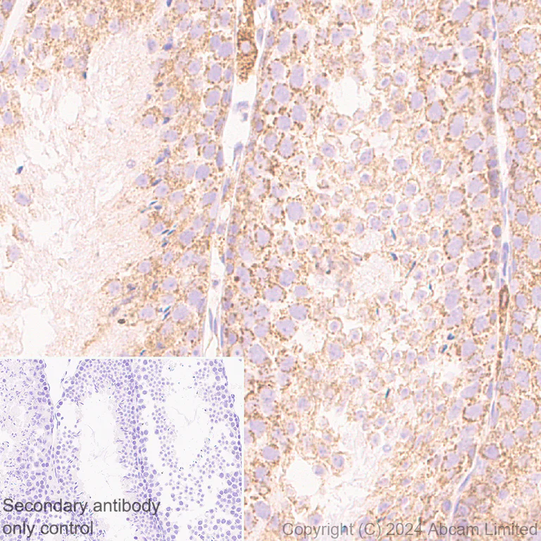 Immunohistochemistry (Formalin/PFA-fixed paraffin-embedded sections) - Anti-MIRO2 antibody [EPR29118-10] - BSA and Azide free (AB321804)