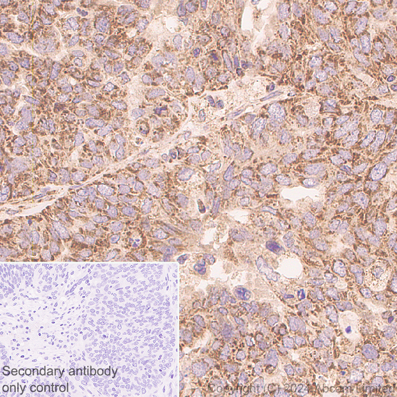 Immunohistochemistry (Formalin/PFA-fixed paraffin-embedded sections) - Anti-MIRO2 antibody [EPR29118-85] (AB320739), expandable thumbnail