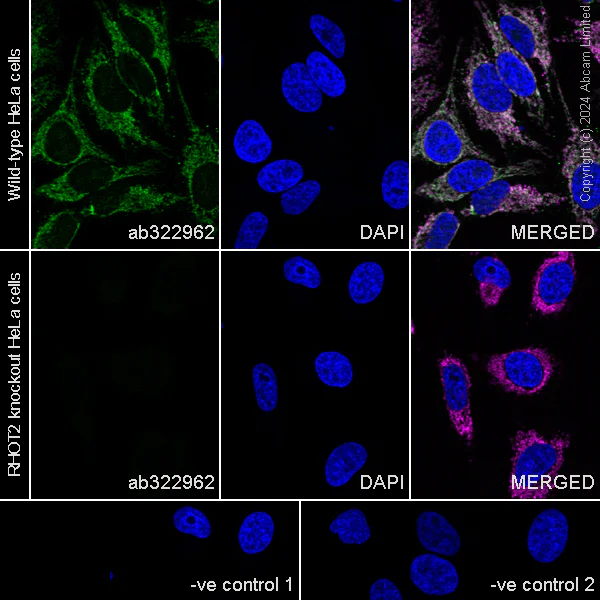 Immunocytochemistry/ Immunofluorescence - Anti-MIRO2 antibody [RM2077] (AB322962)