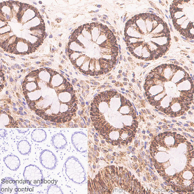 Immunohistochemistry (Formalin/PFA-fixed paraffin-embedded sections) - Anti-MIRO2 antibody [RM2077] (AB322962)